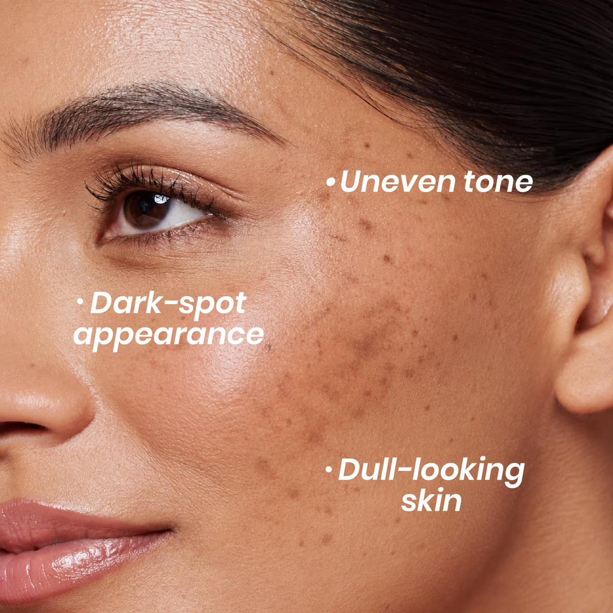 Pigmentation Control & Skin Correction Cream (50g)